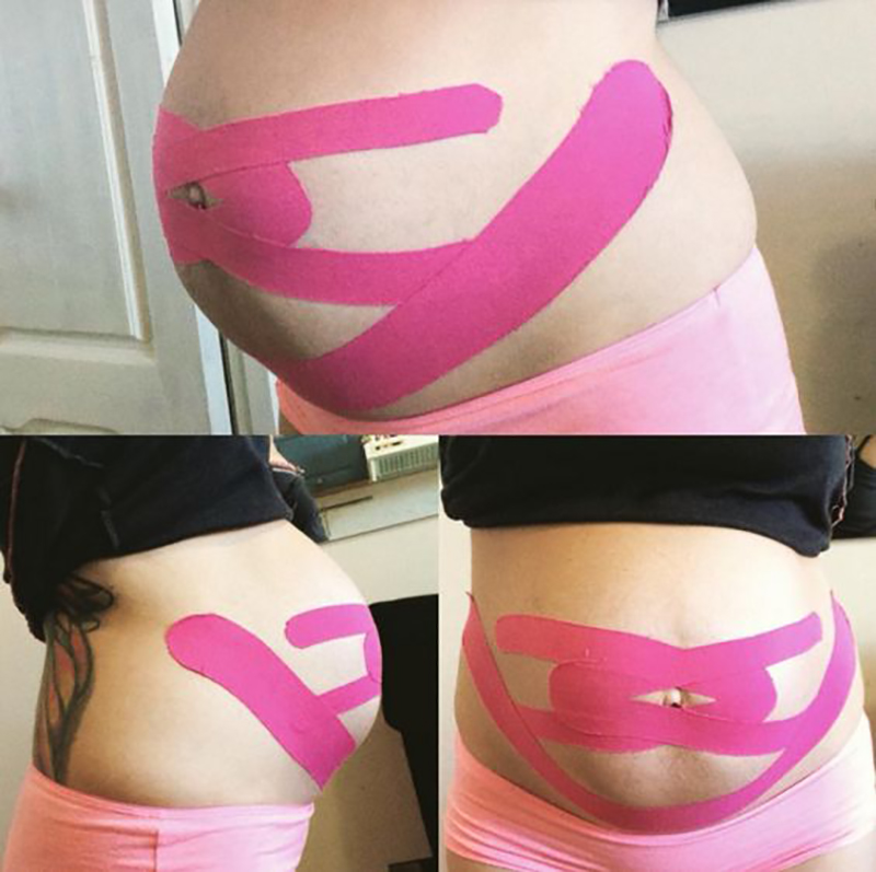 10 Ways to Use Kinesiology Taping for Pregnancy ,kinesiology tape pregnancy.-CAREPROHEALTH- Kinesiology tape, elastic adhesive bandages,Would dressing,Cross Tape,Sports Rigid Tape,Elastic Adhesive Bandage,Stretched Bandage,Cohesive bandage,Underwrap Foam,Ice Hockey Tape,Band aid,Cotton Sports Tape Rayon Sports Tape,Hockey Tape,Finger Tape,PU Tape,PE Tape,Silk Tape,Paper Tape,Heel tape,Wound Dressing, Silicone Patches ( Remove Scar ),Dexcom Patches,Blister band aid,Acne Patches,Toenail Sticker,Mouth Tape,Nipple Covers,Boob Lift Tape,Face Lift Tape,Customized Patches,Assorted Band Aid,Blue Metal Detectabled Band Ai,Different Shape Band Aid,Cartoon Band Aid,Transparent Band Aid,Fabric Band Aid,Waterproof Band Aid,Nitrile Gloves,Anti-virus Gloves,Pl Surgical Gloves,Latex Surgical Gloves,Male Condoms,Female Condoms