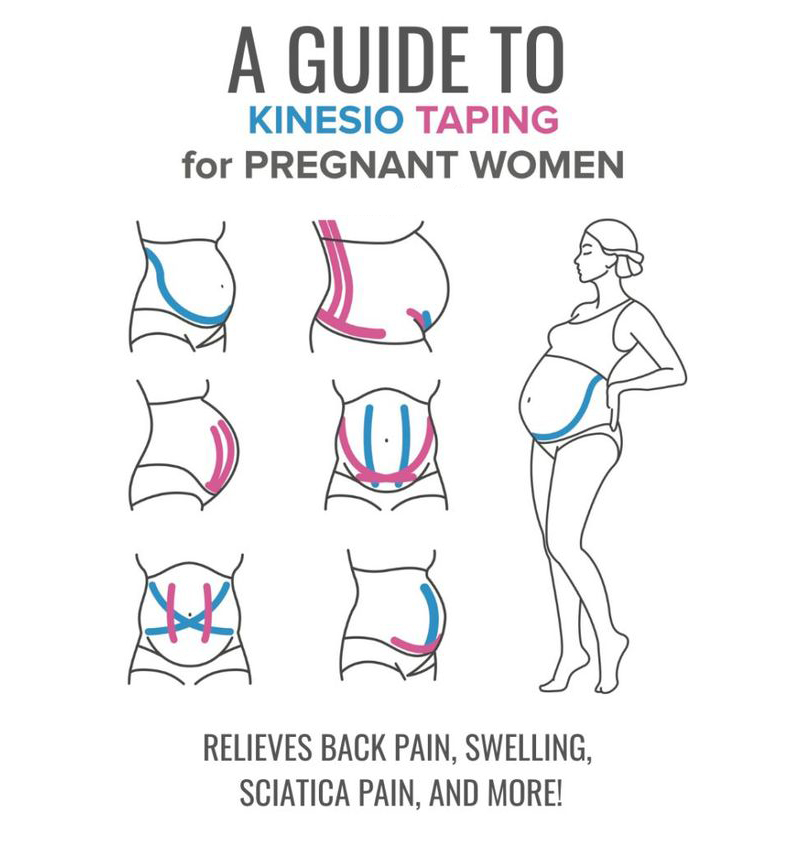 How is work Kinesiology Taping During Pregnancy and Techniques for the  kinesiology tape pregnancy Belly?-CAREPROHEALTH- Kinesiology tape, elastic adhesive bandages,Would dressing,Cross Tape,Sports Rigid Tape,Elastic Adhesive Bandage,Stretched Bandage,Cohesive bandage,Underwrap Foam,Ice Hockey Tape,Band aid,Cotton Sports Tape Rayon Sports Tape,Hockey Tape,Finger Tape,PU Tape,PE Tape,Silk Tape,Paper Tape,Heel tape,Wound Dressing, Silicone Patches ( Remove Scar ),Dexcom Patches,Blister band aid,Acne Patches,Toenail Sticker,Mouth Tape,Nipple Covers,Boob Lift Tape,Face Lift Tape,Customized Patches,Assorted Band Aid,Blue Metal Detectabled Band Ai,Different Shape Band Aid,Cartoon Band Aid,Transparent Band Aid,Fabric Band Aid,Waterproof Band Aid,Nitrile Gloves,Anti-virus Gloves,Pl Surgical Gloves,Latex Surgical Gloves,Male Condoms,Female Condoms