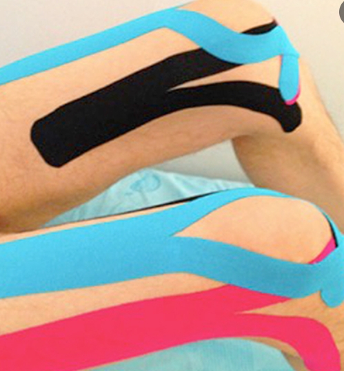 How to apply kinesiology tape quadriceps femoris a strain of the Rectus Femoris / Quadricep muscle strain?-CAREPROHEALTH- Kinesiology tape, elastic adhesive bandages,Would dressing,Cross Tape,Sports Rigid Tape,Elastic Adhesive Bandage,Stretched Bandage,Cohesive bandage,Underwrap Foam,Ice Hockey Tape,Band aid,Cotton Sports Tape Rayon Sports Tape,Hockey Tape,Finger Tape,PU Tape,PE Tape,Silk Tape,Paper Tape,Heel tape,Wound Dressing, Silicone Patches ( Remove Scar ),Dexcom Patches,Blister band aid,Acne Patches,Toenail Sticker,Mouth Tape,Nipple Covers,Boob Lift Tape,Face Lift Tape,Customized Patches,Assorted Band Aid,Blue Metal Detectabled Band Ai,Different Shape Band Aid,Cartoon Band Aid,Transparent Band Aid,Fabric Band Aid,Waterproof Band Aid,Nitrile Gloves,Anti-virus Gloves,Pl Surgical Gloves,Latex Surgical Gloves,Male Condoms,Female Condoms