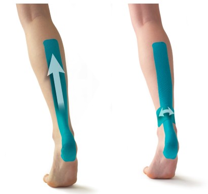 How does Kinesiology Tape For the Achilles Tendon? Carepro Tape made in China-CAREPROHEALTH- Kinesiology tape, elastic adhesive bandages,Would dressing,Cross Tape,Sports Rigid Tape,Elastic Adhesive Bandage,Stretched Bandage,Cohesive bandage,Underwrap Foam,Ice Hockey Tape,Band aid,Cotton Sports Tape Rayon Sports Tape,Hockey Tape,Finger Tape,PU Tape,PE Tape,Silk Tape,Paper Tape,Heel tape,Wound Dressing, Silicone Patches ( Remove Scar ),Dexcom Patches,Blister band aid,Acne Patches,Toenail Sticker,Mouth Tape,Nipple Covers,Boob Lift Tape,Face Lift Tape,Customized Patches,Assorted Band Aid,Blue Metal Detectabled Band Ai,Different Shape Band Aid,Cartoon Band Aid,Transparent Band Aid,Fabric Band Aid,Waterproof Band Aid,Nitrile Gloves,Anti-virus Gloves,Pl Surgical Gloves,Latex Surgical Gloves,Male Condoms,Female Condoms