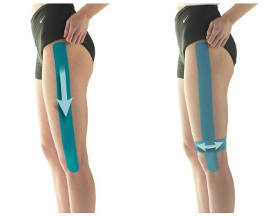 How does Kinesiology Tape For IT Band Pain? Carepro Tape made in China-CAREPROHEALTH- Kinesiology tape, elastic adhesive bandages,Would dressing,Cross Tape,Sports Rigid Tape,Elastic Adhesive Bandage,Stretched Bandage,Cohesive bandage,Underwrap Foam,Ice Hockey Tape,Band aid,Cotton Sports Tape Rayon Sports Tape,Hockey Tape,Finger Tape,PU Tape,PE Tape,Silk Tape,Paper Tape,Heel tape,Wound Dressing, Silicone Patches ( Remove Scar ),Dexcom Patches,Blister band aid,Acne Patches,Toenail Sticker,Mouth Tape,Nipple Covers,Boob Lift Tape,Face Lift Tape,Customized Patches,Assorted Band Aid,Blue Metal Detectabled Band Ai,Different Shape Band Aid,Cartoon Band Aid,Transparent Band Aid,Fabric Band Aid,Waterproof Band Aid,Nitrile Gloves,Anti-virus Gloves,Pl Surgical Gloves,Latex Surgical Gloves,Male Condoms,Female Condoms