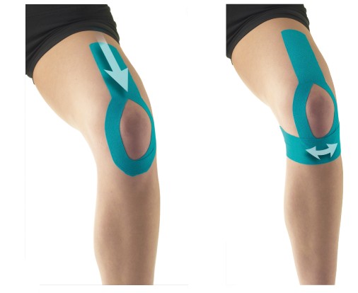 How does Kinesiology Tape For Knee Pain? Carepro Tape made in China-CAREPROHEALTH- Kinesiology tape, elastic adhesive bandages,Would dressing,Cross Tape,Sports Rigid Tape,Elastic Adhesive Bandage,Stretched Bandage,Cohesive bandage,Underwrap Foam,Ice Hockey Tape,Band aid,Cotton Sports Tape Rayon Sports Tape,Hockey Tape,Finger Tape,PU Tape,PE Tape,Silk Tape,Paper Tape,Heel tape,Wound Dressing, Silicone Patches ( Remove Scar ),Dexcom Patches,Blister band aid,Acne Patches,Toenail Sticker,Mouth Tape,Nipple Covers,Boob Lift Tape,Face Lift Tape,Customized Patches,Assorted Band Aid,Blue Metal Detectabled Band Ai,Different Shape Band Aid,Cartoon Band Aid,Transparent Band Aid,Fabric Band Aid,Waterproof Band Aid,Nitrile Gloves,Anti-virus Gloves,Pl Surgical Gloves,Latex Surgical Gloves,Male Condoms,Female Condoms